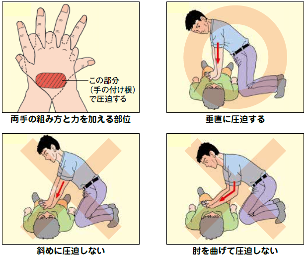 手の付け根で圧迫する。垂直に圧迫する。斜めに圧迫しない。肘を曲げて圧迫しない。