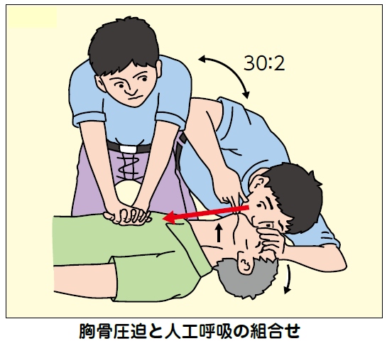 胸骨圧迫と人工呼吸の組合せ