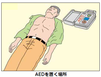 AEDを傷病者の近くに置く