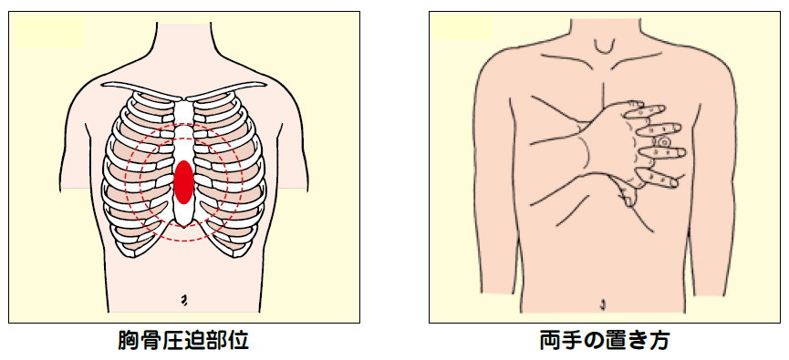 胸 の 真ん中 圧迫 感